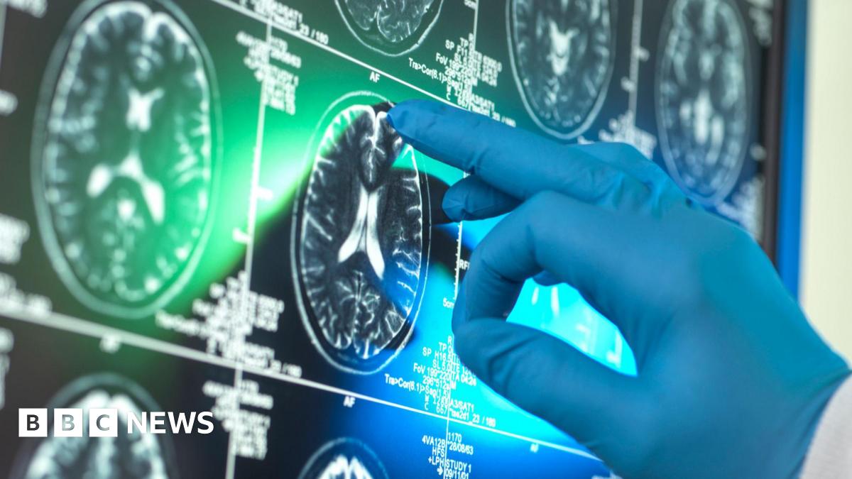 A blue gloved hand points a middle finger at a screen showing a collection of black and white scans of cross-sections of the brain. They look like white ovals where the outline of the skull is visible.