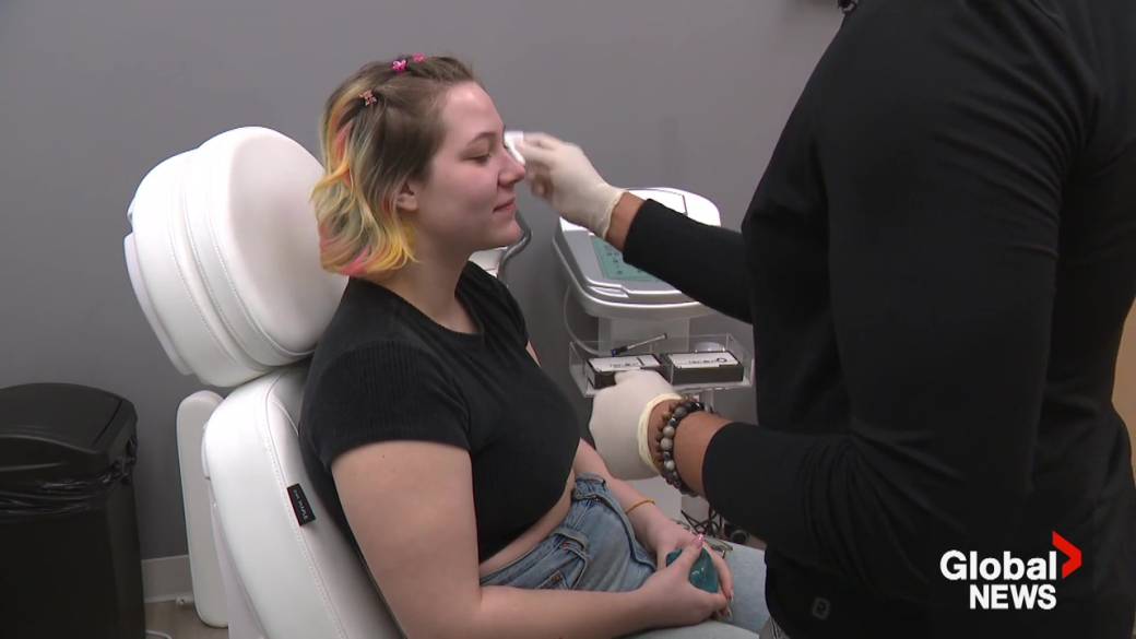 Click to play video: 'Migraine sufferers say changing winter weather is worsening their symptoms'