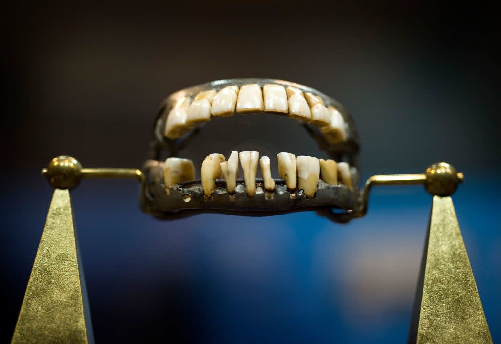 Close-up of an old set of mounted dentures with discolored teeth displayed on a stand