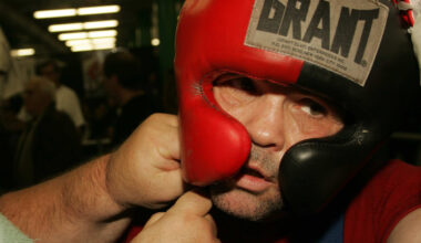 Alex Hilton has his boxing headgear adjusted.