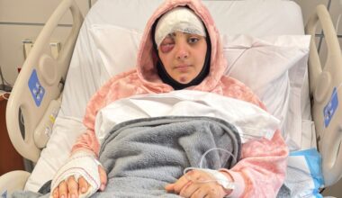 Wounded Lebanese journalist recounts hours of agony when Israeli strike killed colleague