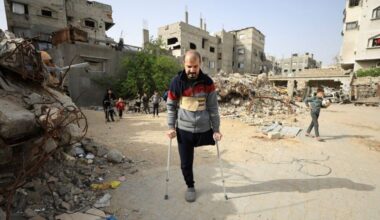 Gaza's War Amputees Short of Prostheses Under Israeli Restrictions
