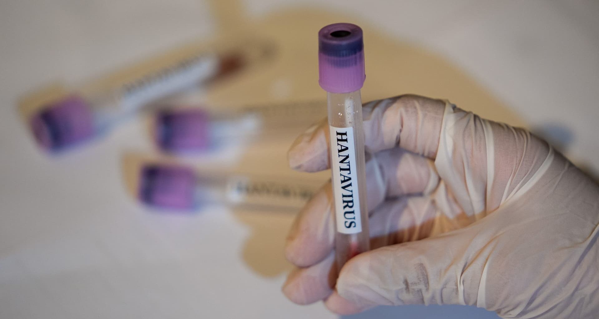 CDC says there are no U.S. hantavirus cases currently, 41 people being monitored