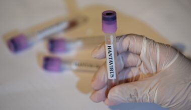 CDC says there are no U.S. hantavirus cases currently, 41 people being monitored