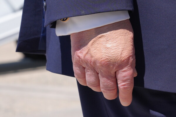 President Donald Trump's right hand is seen as he speaks to the press after returning and stepping off Air Force One, Wednesday, May 20, 2026, at Joint Base Andrews, Md., after speaking at the U.S. Coast Guard Academy commencement. (AP Photo/Jacquelyn Martin)