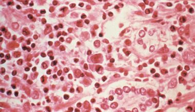 Three dead in suspected hantavirus outbreak on Atlantic cruise ship | Health News