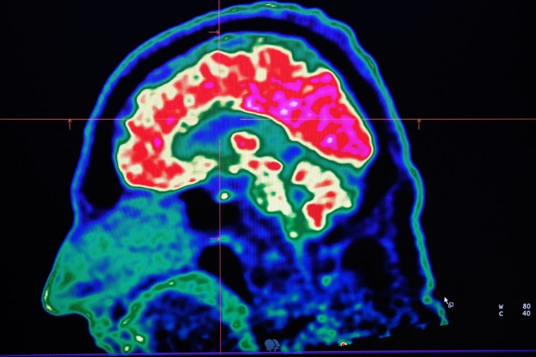 American scientists this week revealed research showing that women's brains are "younger" than those of men.
