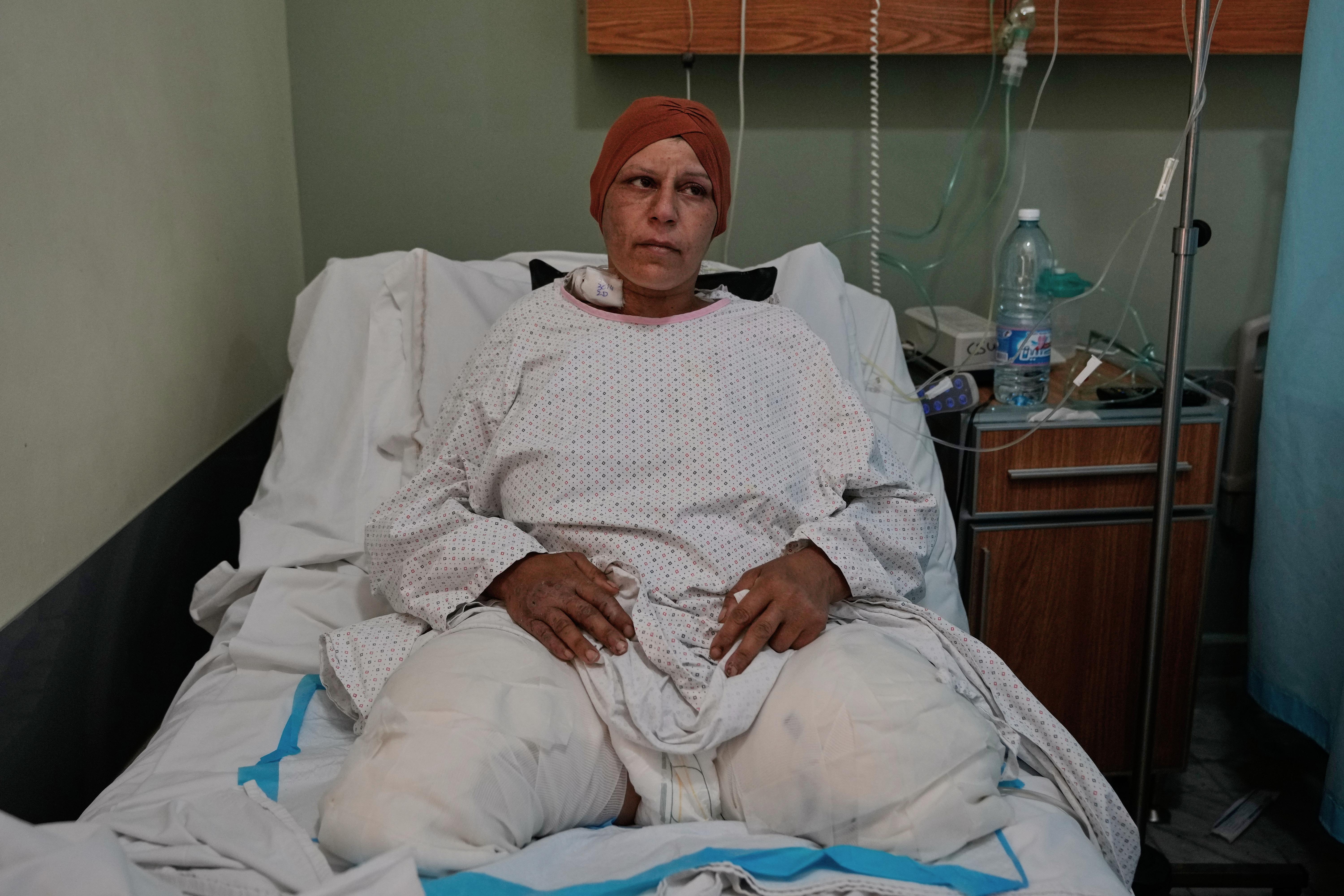 Sanaa Khalil, 35, a Syrian farmer who lost her two legs