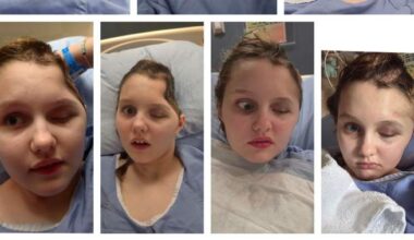Maya Gebala could have undergone her last surgery, mother says