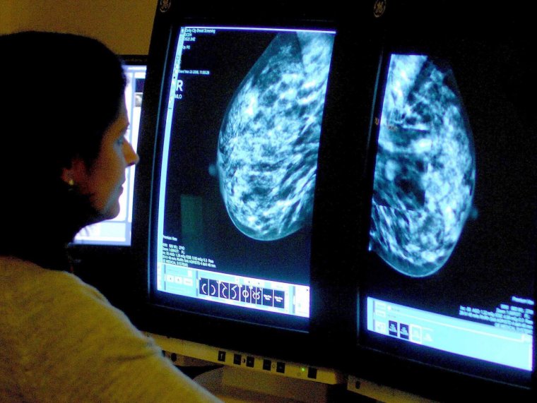 EMBARGOED TO 0001 SUNDAY JULY 23 File photo dated 15/06/06 of a consultant analysing a mammogram. A health board has sent hundreds cancer patients to other parts of Scotland for treatment as it tries to attract new consultants to treat those with the disease, it has emerged. Labour is demanding the Scottish Government work with NHS Tayside to tackle the situation there as a 