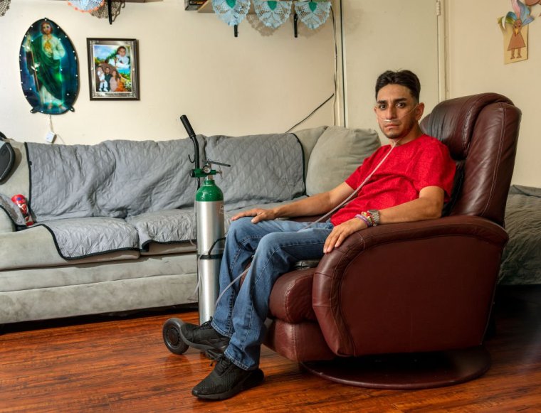 PACOIMA, CA-SEPTEMBER 8, 2023: Leobardo Segura Meza, 27, who suffers from silicosis, an incurable lung disease that has been afflicting workers who cut and polish engineered stone high in silica, is photographed at his home in Pacoima. (Mel Melcon / Los Angeles Times via Getty Images)