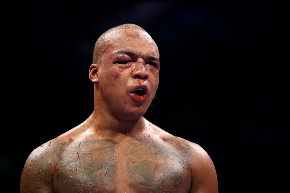 Fabio Wardley looks on during the WBO World Heavyweight Title fight between Fabio Wardley and Daniel Dubois as part of the Wardley v Dubois Don't Blink fight card at Co-op Live on May 09, 2026 in Manchester, England