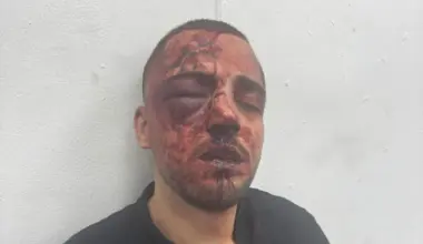 Police officers said to beat, break nose and arrest Arab prosecutor over noise complaint