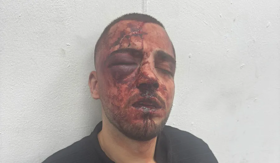 Police officers said to beat, break nose and arrest Arab prosecutor over noise complaint
