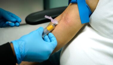 There's a new name for a hormonal condition affecting 1 in 8 women worldwide
