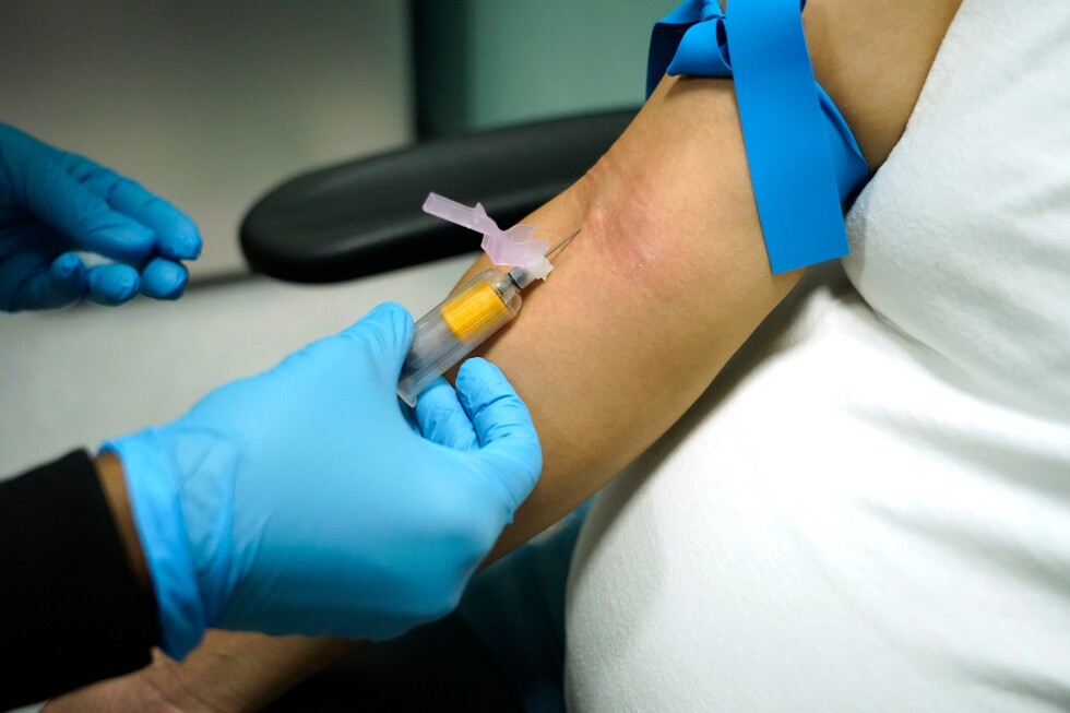 There's a new name for a hormonal condition affecting 1 in 8 women worldwide