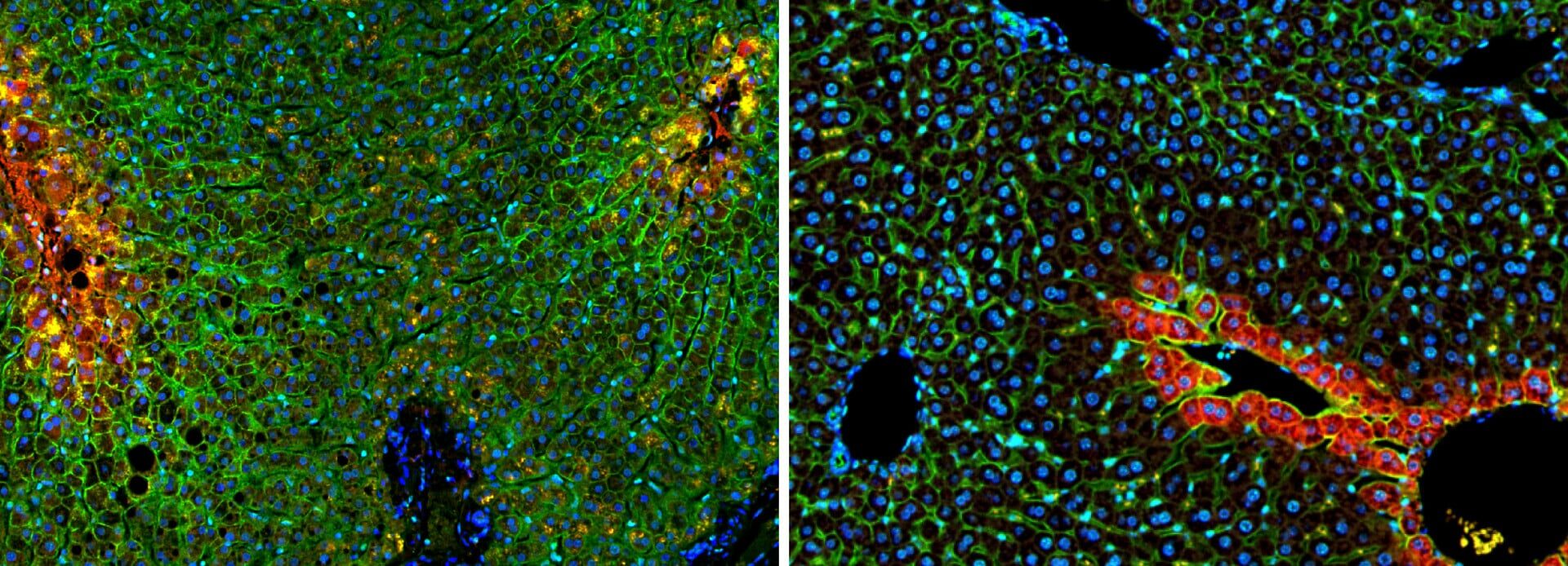 In world first, Israeli scientists map digital atlas of healthy human liver