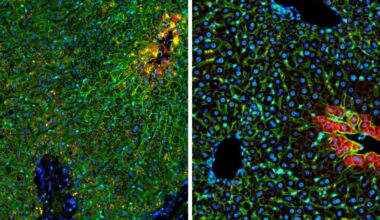 In world first, Israeli scientists map digital atlas of healthy human liver