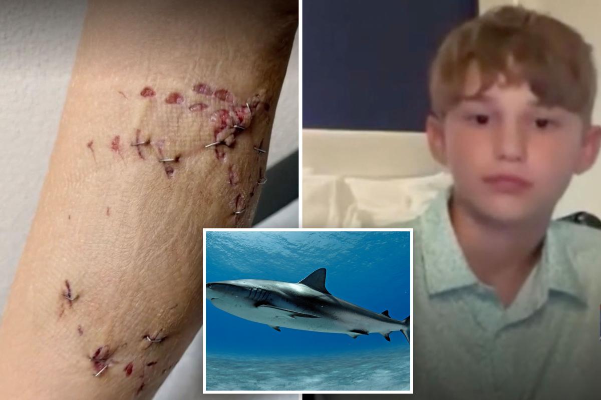 Boy, 12, saved by older brother after shark attack on Bahamas family vacation