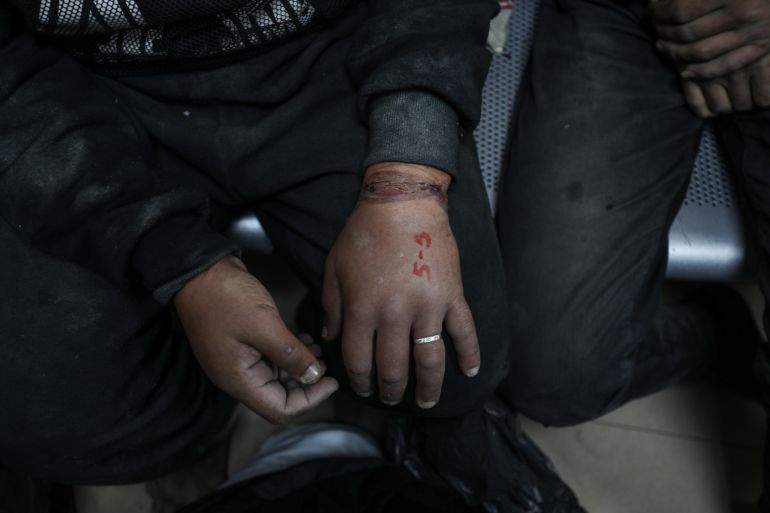One of the Palestinian men arrested and tortured for days by Israeli soldiers shows the number he was marked by, and his swollen hand from the handcuffs