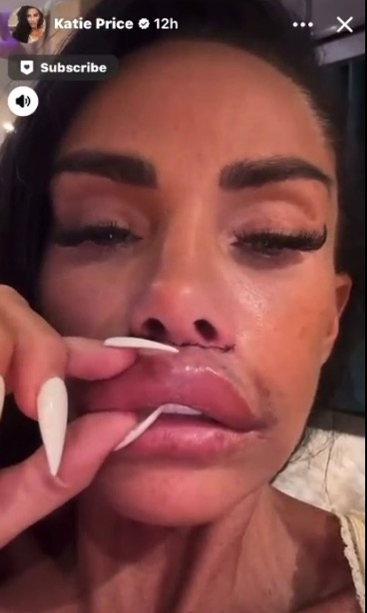Katie Price's daughter Princess does not agree with latest surgery