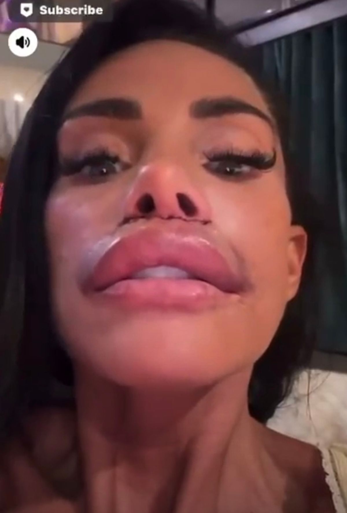 Katie Price shows off wonky nose in graphic pic