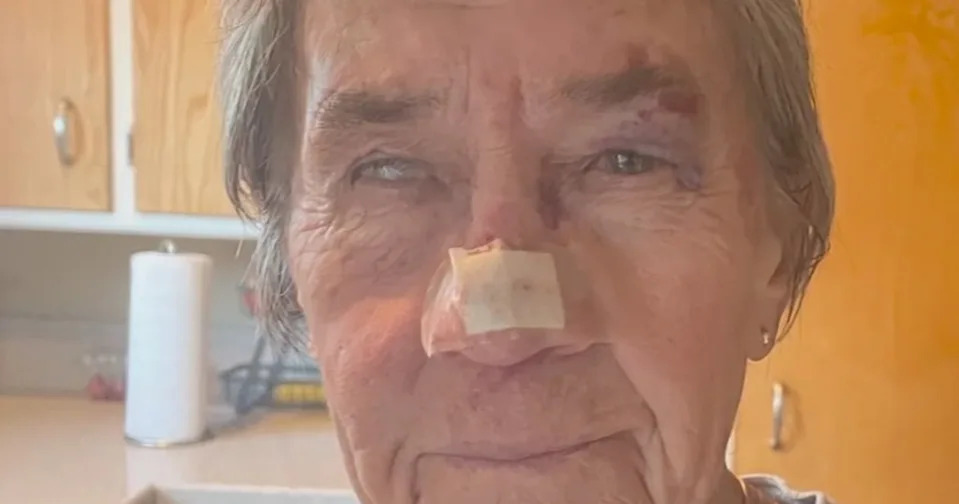 Mary Jo Kelly, a longtime resident of the Bay Area city, said she was out walking last Thursday when two of the birds attacked her from behind, sending her crashing to the ground. ABC7