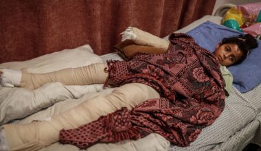 ‘Between pain and fear’: Gaza children bear cost of ongoing Israeli attacks | Israel-Palestine conflict News