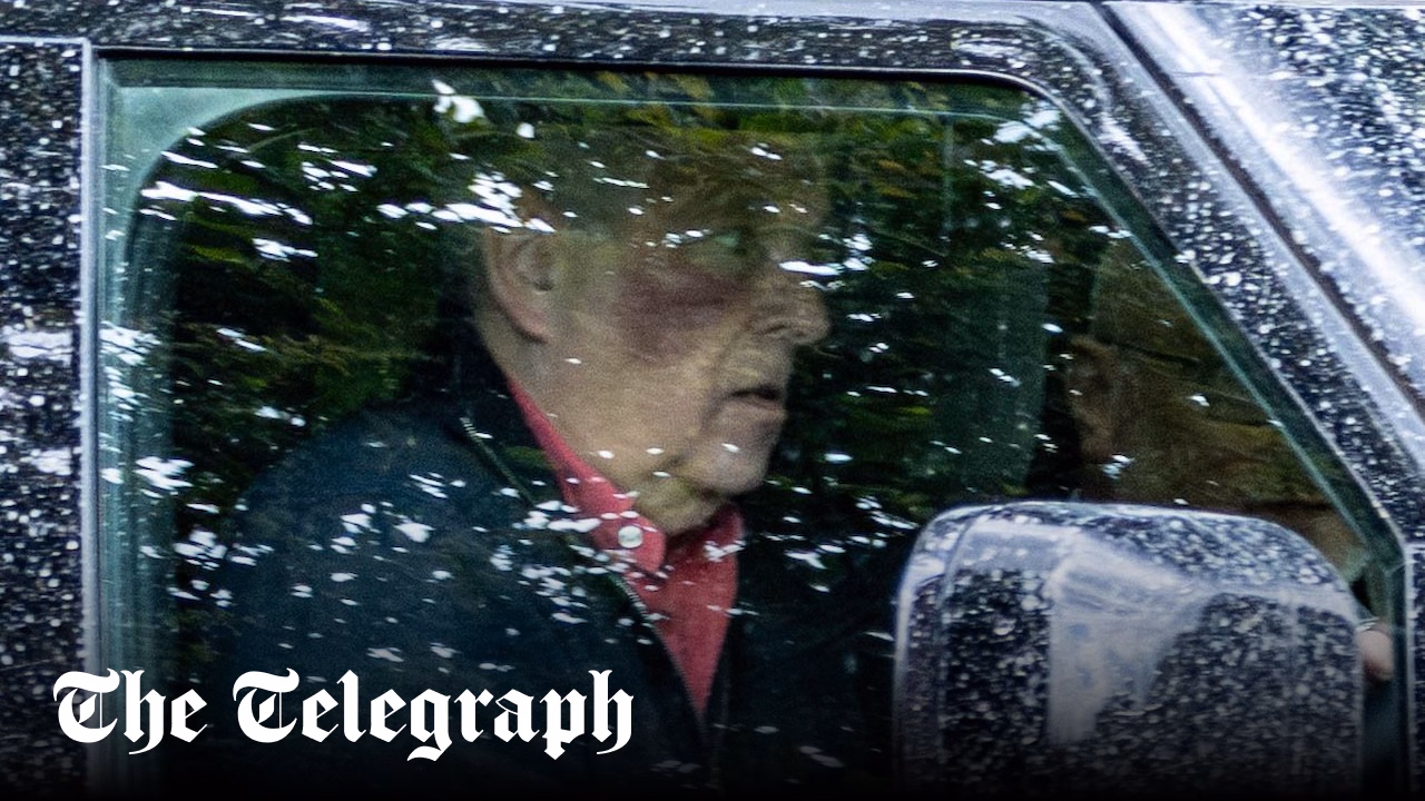 Andrew pictured with bruised face