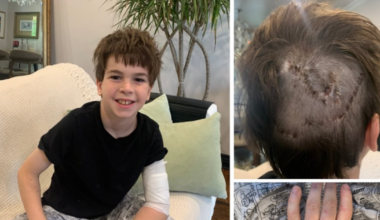 Dog attack victim in Barrie, Ont., speaks out