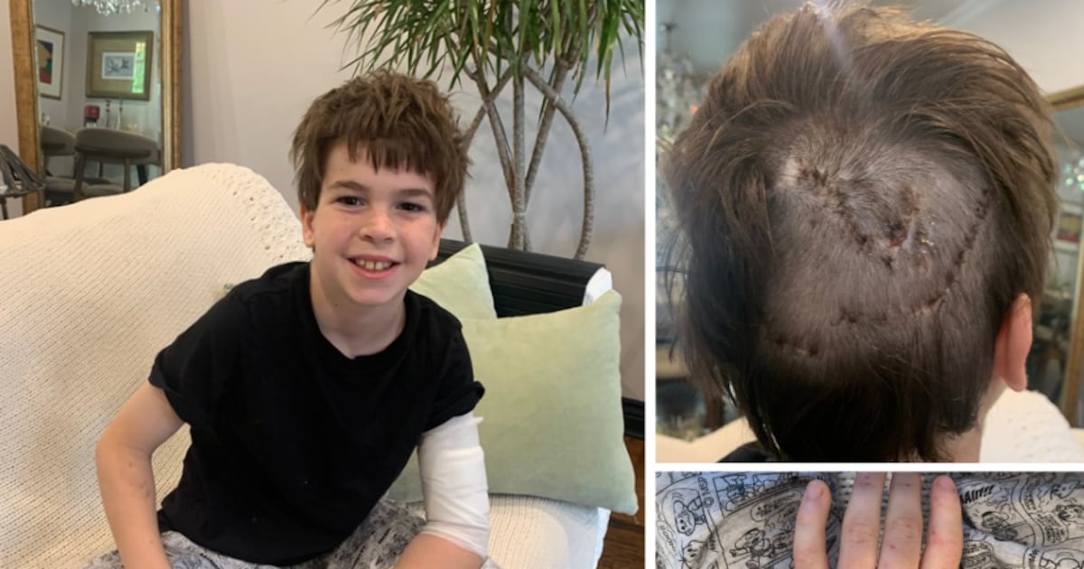 Dog attack victim in Barrie, Ont., speaks out