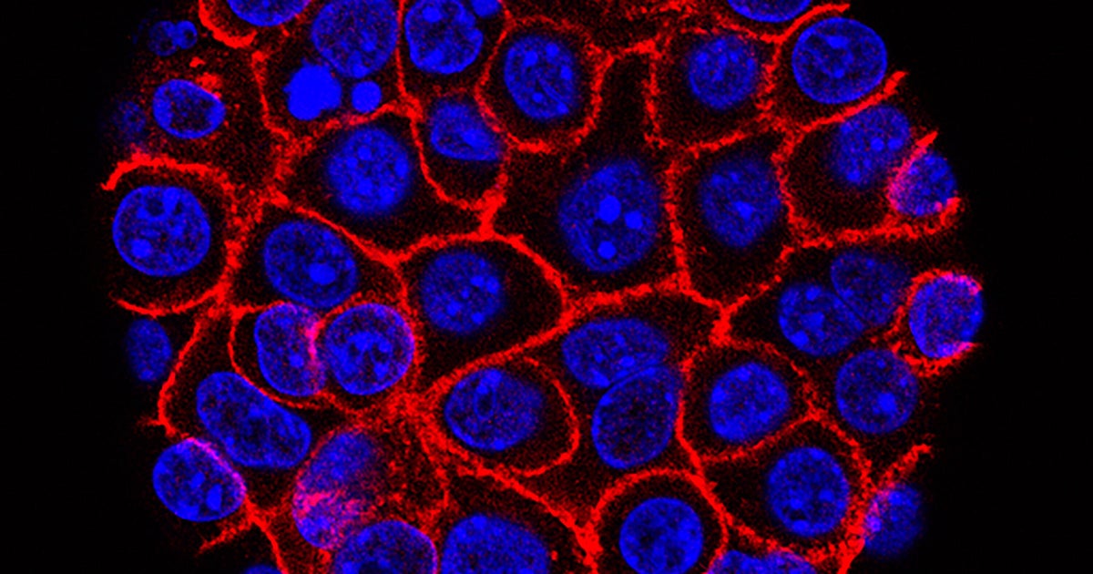 Pancreatic Cancer Drug