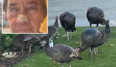 California woman left with horrific injuries after being attacked by gang of wild turkeys