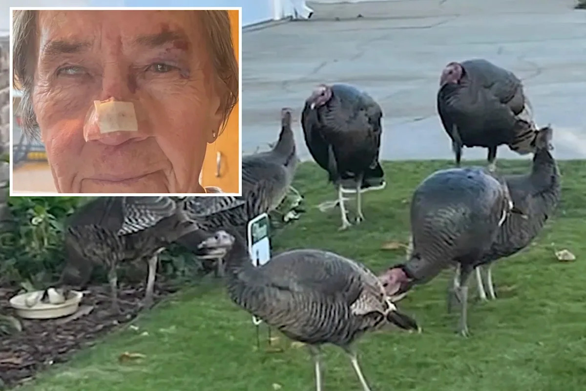 California woman left with horrific injuries after being attacked by gang of wild turkeys