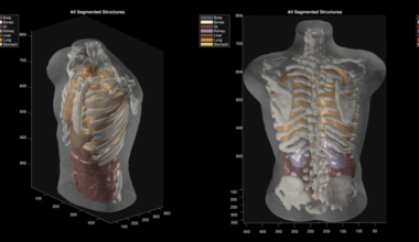 Midjourney Medical goes from AI image generation to full-body ultrasounds