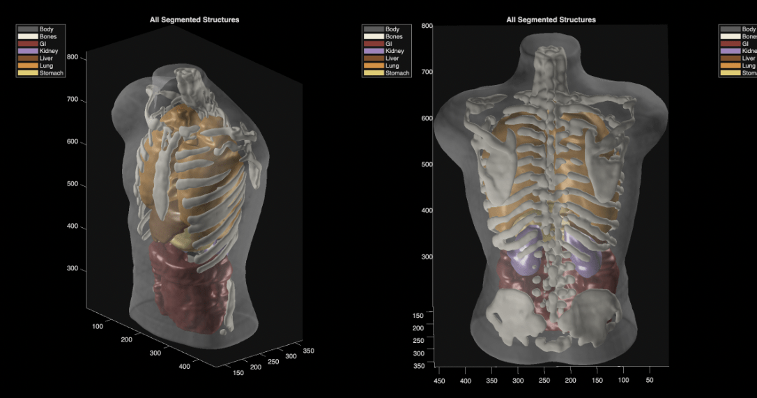 Midjourney Medical goes from AI image generation to full-body ultrasounds