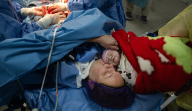 Underground Births, Under Bombardment: Childbearing in Ukraine