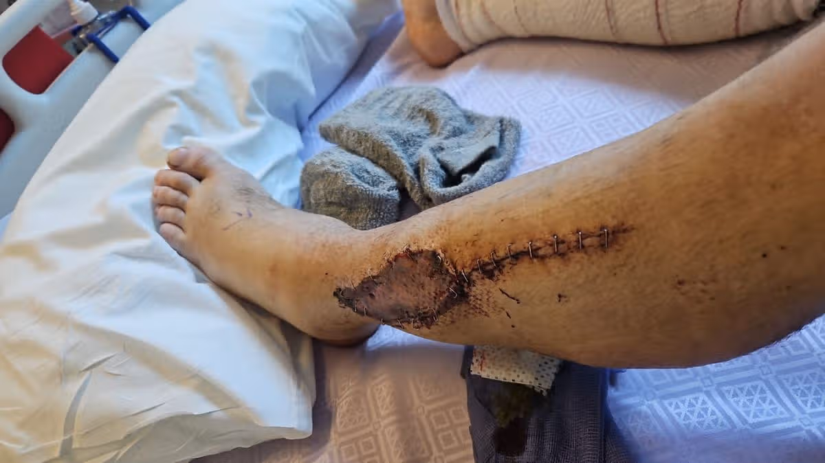 David Forbes was on his way to his local chippy in Croxteth, Liverpool, when he was shot in the legs by Daniel Lawless - a complete stranger who opened fire on him for no reason.