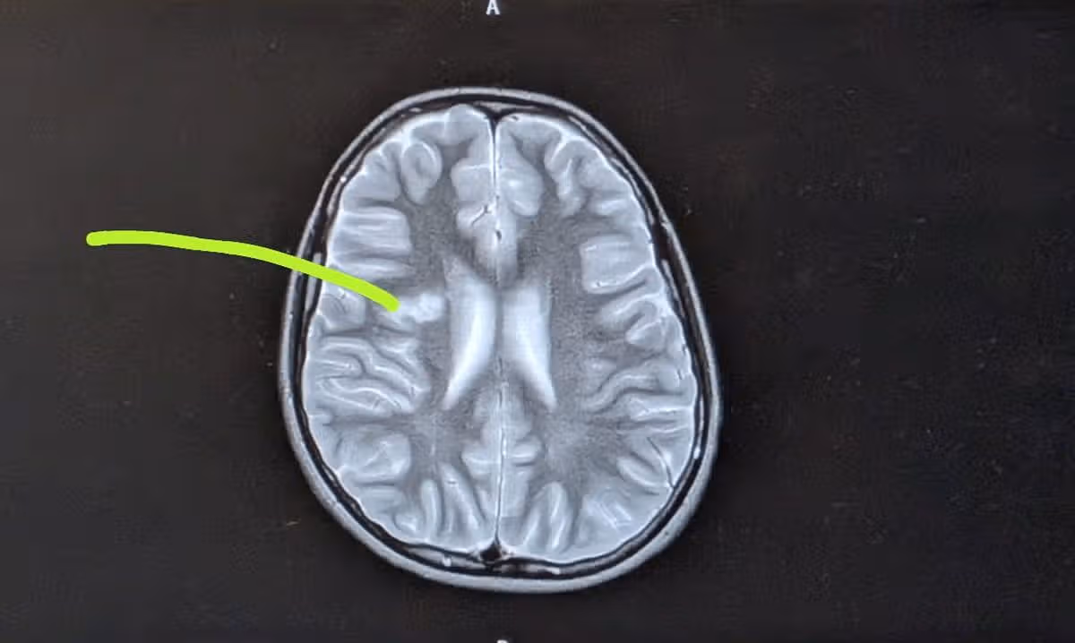 Ruben Shears' brain scan