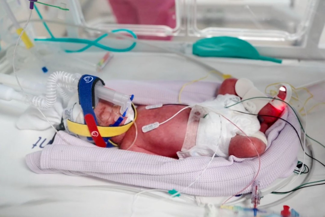 It Was a Surprise Pregnancy, and an Unbelievably Rare One