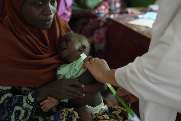 Halimah Muhammad, a local health worker, right, attends to a child suffering from malnutrition, as his mother Larai Malami, a 35-year-old mother of 10, holds him at the Rumbukawa Primary Health Centre in Sokoto, northwestern Nigeria, Thursday, July 16, 2026. (AP Photo/Sunday Alamba)