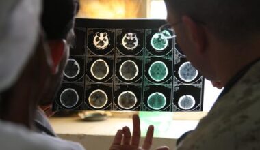 Iran war brain injuries could outlast US troops’ return to duty