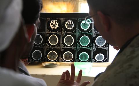 Iran war brain injuries could outlast US troops’ return to duty