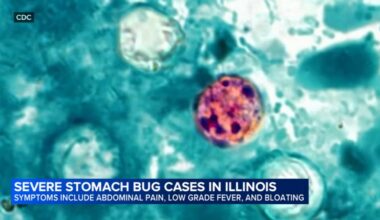 What is cyclosporiasis? Dozens of cases of stomach bug going around reported in Illinois as parasite outbreak grows: IDPH