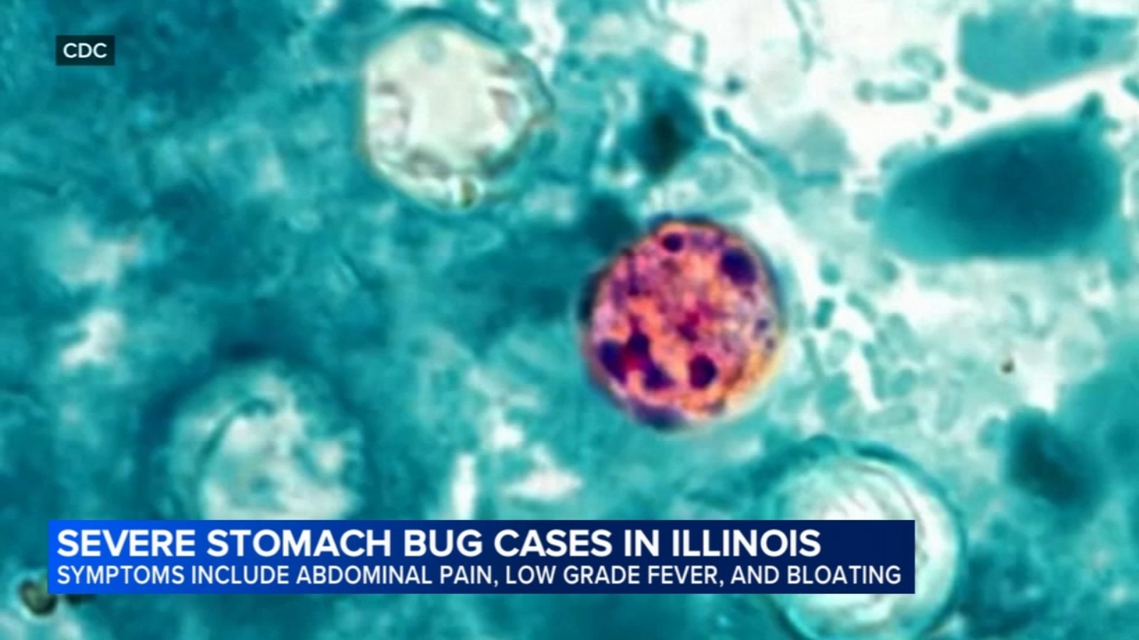 What is cyclosporiasis? Dozens of cases of stomach bug going around reported in Illinois as parasite outbreak grows: IDPH