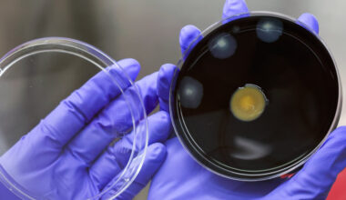 Second Patient Dies in Outbreak of Legionnaires’ Disease in Manhattan