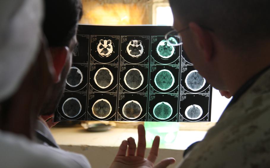  Two men examine a sheet of brain scan images held up to the light.