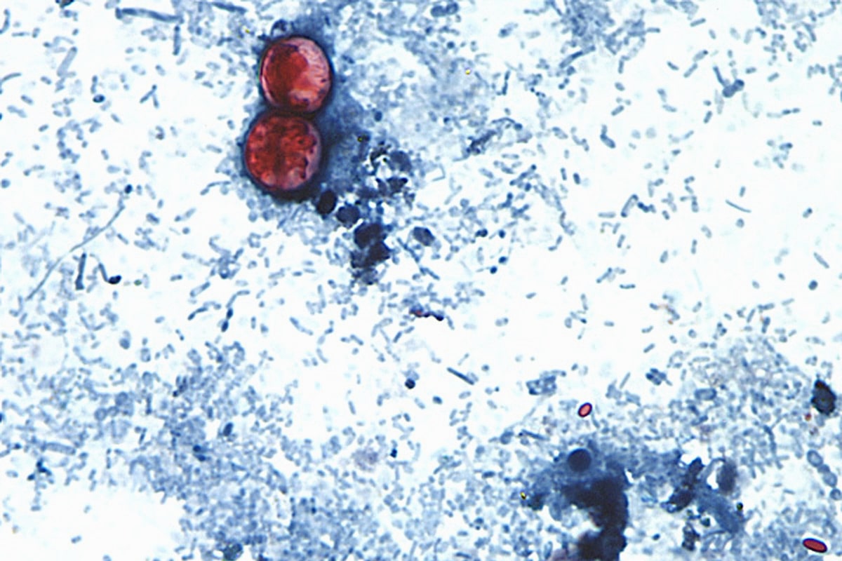 Taylor Farms cyclospora test result was a false positive, FDA says