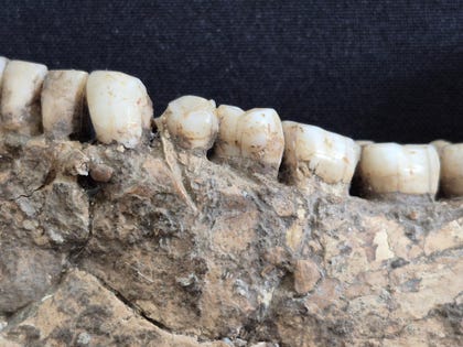 mandible of Qafzeh-25
