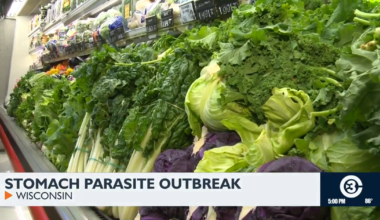 Doctors urge produce washing after diarrhea-causing parasite outbreak sickens 145 | News